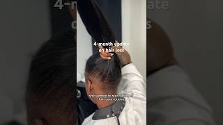 Update On Hair Loss After Wearing Wigs All The Time