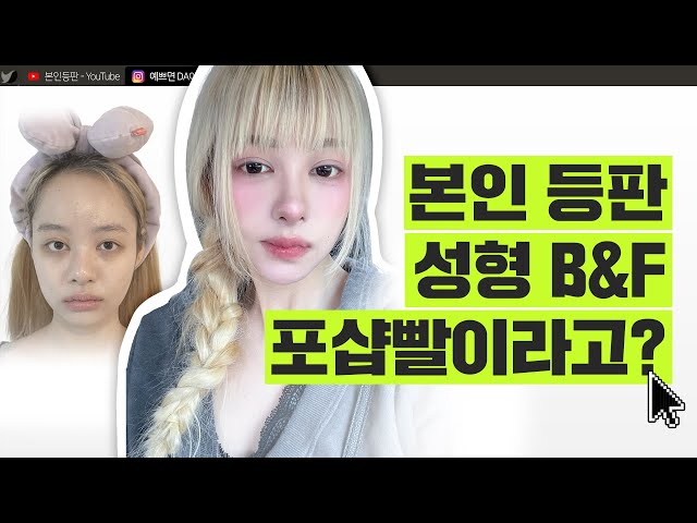 이마축소부터 윤곽성형까지! 가장 만족스러운 성형 부위는 ㅣ 디에이성형외과 ㅣ 디에이성형외과의원