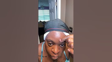Trying the Qustere pimple patches.. #pimplepatches #qustere