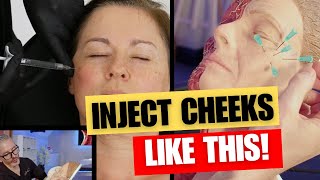 How To Inject The Cheeks. Cheek Injection Points Tutorial.