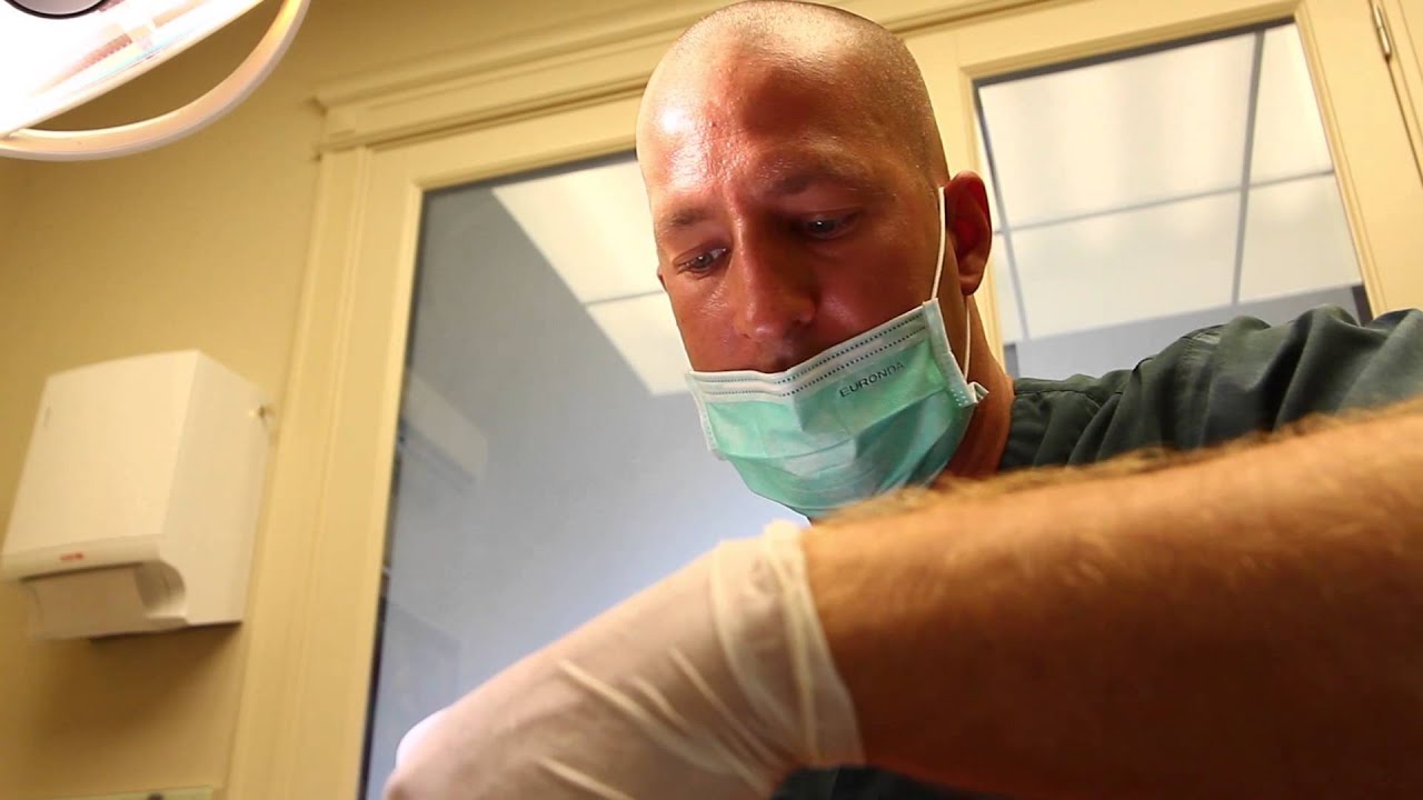 Root canal treatment