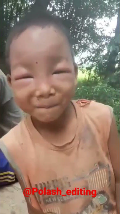 Borole kamurile kela🤣||see a small Assamese kid bitten by a bee🤣 funny moment