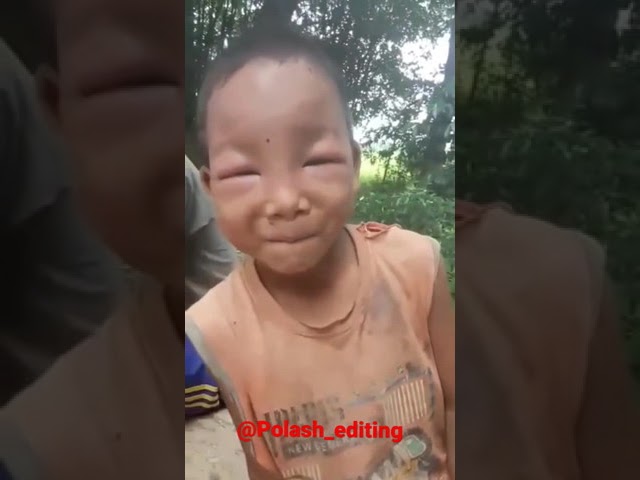 Borole kamurile kela🤣||see a small Assamese kid bitten by a bee🤣 funny moment class=