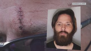 Sacramento man trying to break up fight recovering after being stabbed