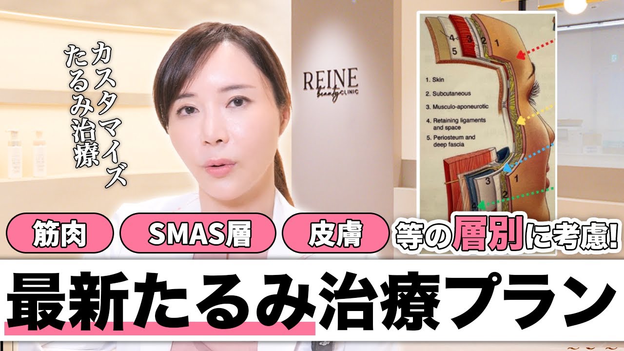 【たるみ治療】失敗しない顔の層別たるみ治療プランを紹介します