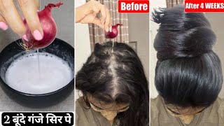 I apply just 3 Drops👆🏼of this Mix on bald scalp-Got Unstoppable Extreme Hair Growth-Dense Long Hair