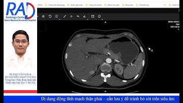 Dị dạng động tĩnh mạch thận– những điểm mới trong Chẩn đoán hình ảnh và can thiệp điện quang