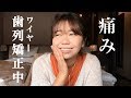 「なごの矯正日記#16」歯列矯正中の痛み トップ５