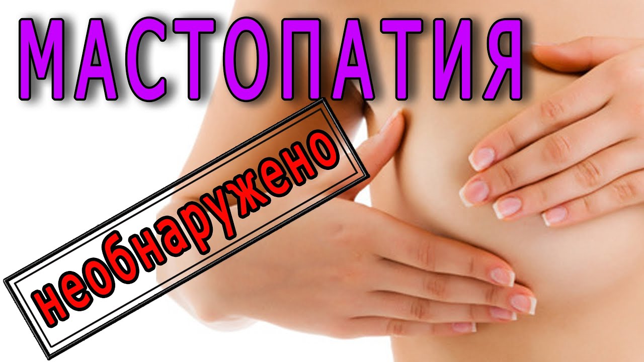 МАСТОПАТИЯ. Лечение Мастопатии. - YouTube