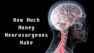 How Much Do Neurosurgeons Make?