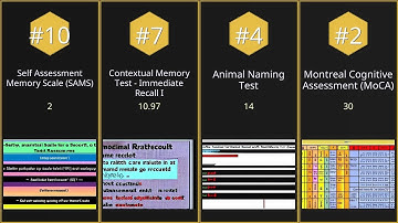 【Top 10】Most precise memory recall by test score【Searched in 2025】