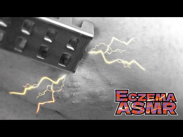 【眠りへと導くアトピー性皮膚炎ASMR】超痒い脚のブツブツを鱗取りで掻く音/癒し/リラックス効果/睡眠導入/マッサージ【モノクロ版】
