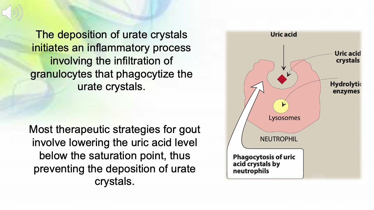Nisstex and Gout