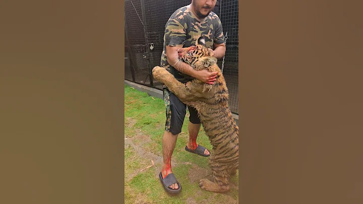 Bengal Tiger Bites and Injured my Legs | Nouman Hassan |