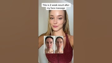 2 Week Face Massage Results (Client Before/After)