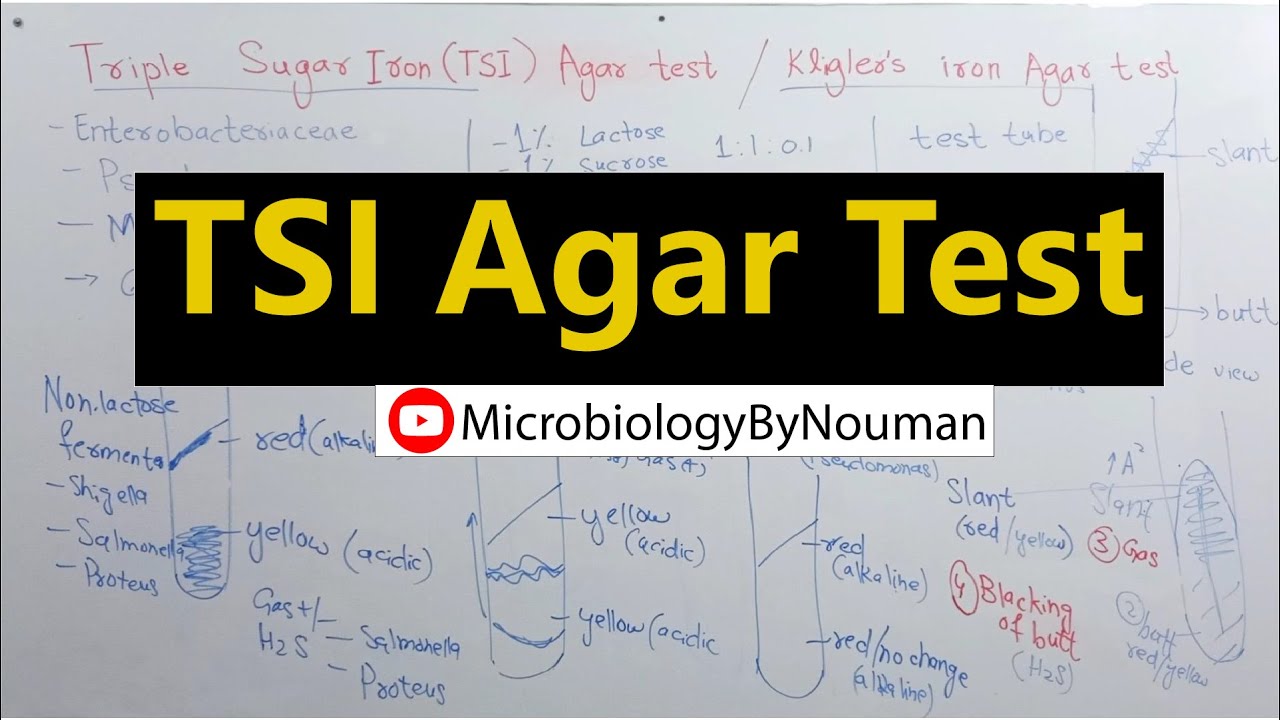 tsi-agar-test-triple-sugar-iron-agar-test-youtube