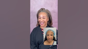 Facelift Takes Off 20 Years 🤯 Life Changing Plastic Surgery