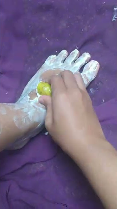 menghilangkan belang di kaki
