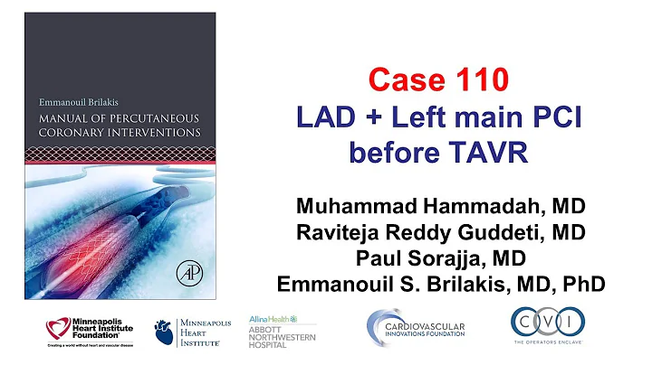 Case 110: PCI Manual - Complicated PCI before TAVR