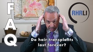 Do Hair Transplants Last Forever? | FAQ