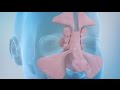 Sinusitis and Sinus Surgery Explained (Balloon Sinuplasty and Endoscopic Sinus Surgery)