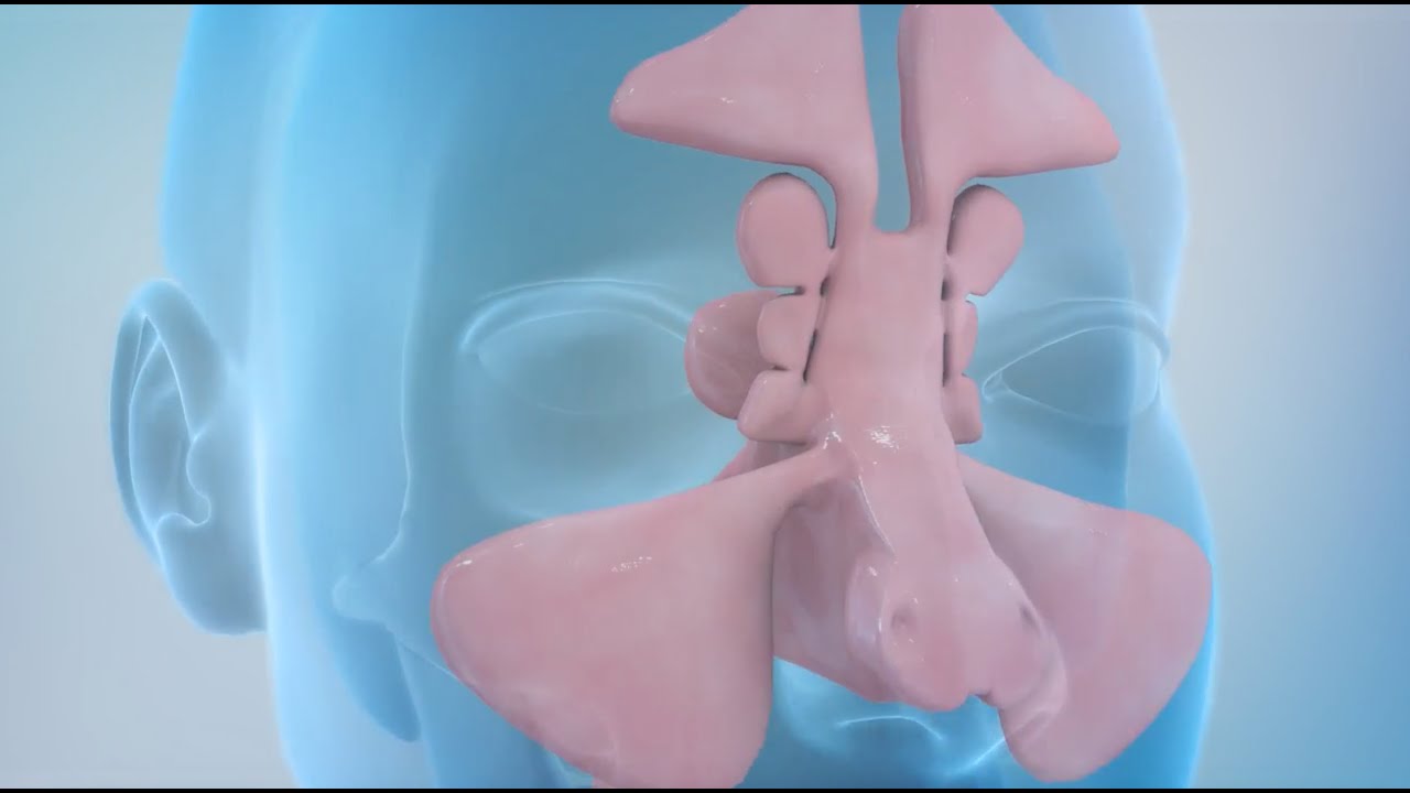 Sinus Rinse Animation - YouTube