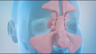 Sinusitis and Sinus Surgery Explained (Balloon Sinuplasty and Endoscopic Sinus Surgery)