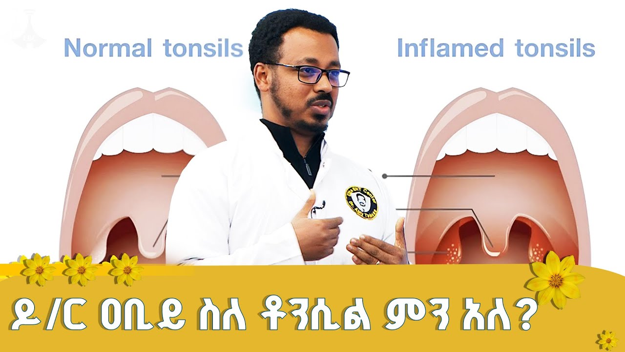 ዶ/ር ዐቢይ ስለ ቶንሲል ምን አለ?   #ebcdotstream #etv #EBC #ጤናዎበቤትዎ #የቶንሲልህመም # ዐቢይ ታደሰ