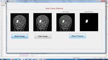 brain tumour detection using image processing  matlab, Brain tumour using MRI Images