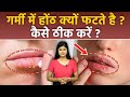 गर्मियों में होंठ क्यों फटते है | Garmi Me Fate Hoto Ka Ilaj | Dry Lips In Summer Reason | Boldsky