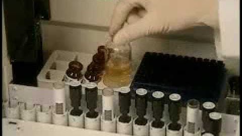 Automatul de imunologie AIA-600II