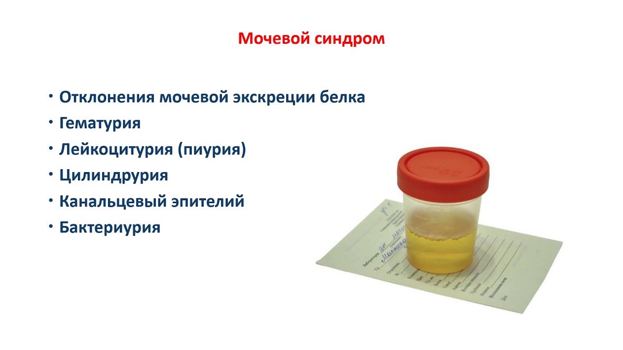 Сколько держится анализ мочи