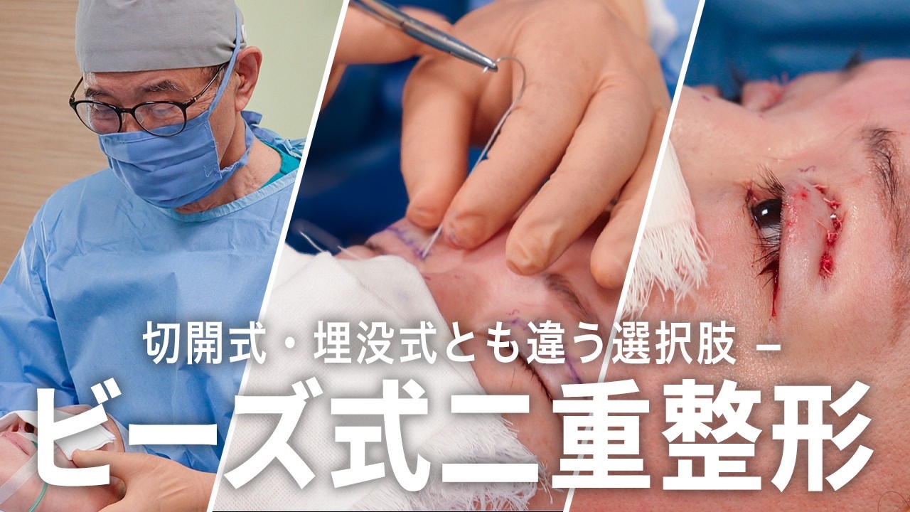 Double Eyelid Surgery] A distinct double eyelid surgery that is