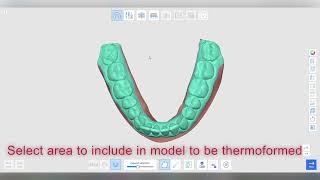 Simple orthodontic movements with the Medit Ortho Simulation app screenshot 1