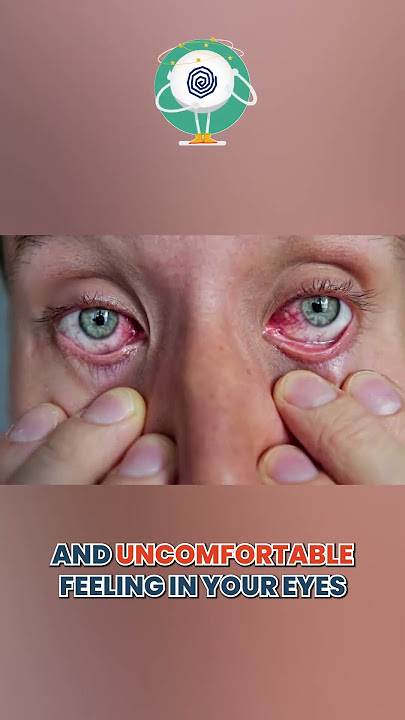 Symptoms of dry eyes