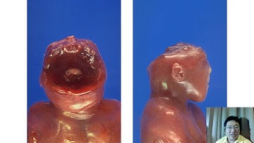 Pathology of the central nervous system (laboratory) plus review for pathology of the eye and ear