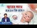 জ্বরের সাথে বাচ্চার শরীরে Rash কেন হয়? | Fever with rash explained | Dr. Arpan Saha