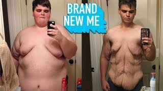 I Lost 230lbs And I’m Proud Of My Saggy Skin | BRAND NEW ME