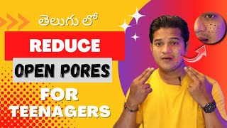 How To Reduce Open Pores In Just 10 Days I Telugu | OPEN PORES ని తగించుకోండి 10 రోజుల్లో 