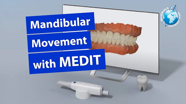 Mandibular Movement with Medit