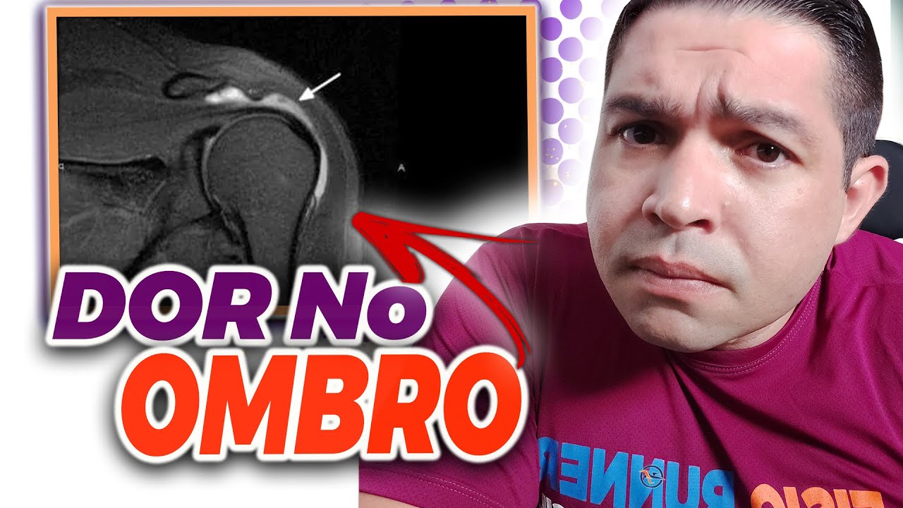 DOR NO OMBRO | SÍNDROME DO IMPACTO DO OMBRO | FISIOTERAPIA