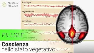 COSCIENZA: tecniche di imaging per studiare lo stato vegetativo dopo il coma - Pillola #2