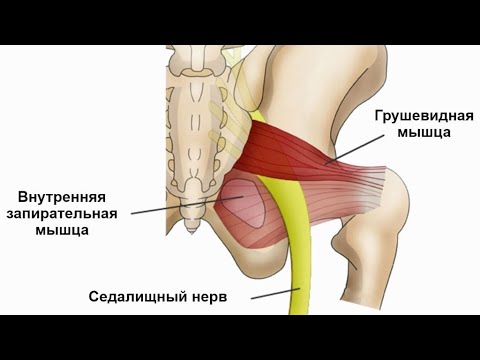 Грушевидная Мышца Где Находится Фото У Женщин