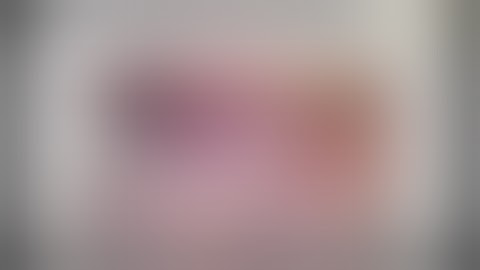 Laparoscopy Liver Resection for Giant Intrahepatic Cholangiocarcinoma