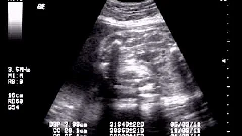7 meses kenneth daniel berndt