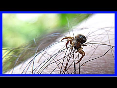 Vidéo: Épigénétique Dans Les Cellules Souches Cancéreuses