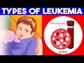 Leukemia explained | Acute Leukemia, Chronic Leukemia and Types of Leukemias Explained