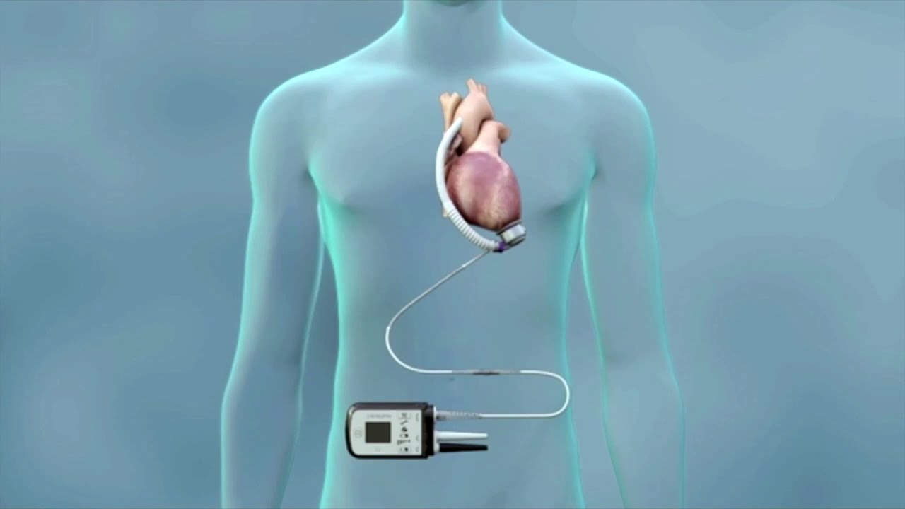 Scandalo corruzione alla Cardiochirurgia di Chieti