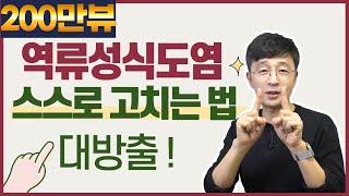 역류성식도염 스스로 고치는 법을 대방출합니다. 이대로만 해보세요.