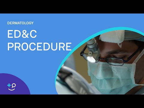 ED&C Procedure Overview [Dermatology]
